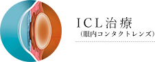 ICL治療（眼内コンタクトレンズ）